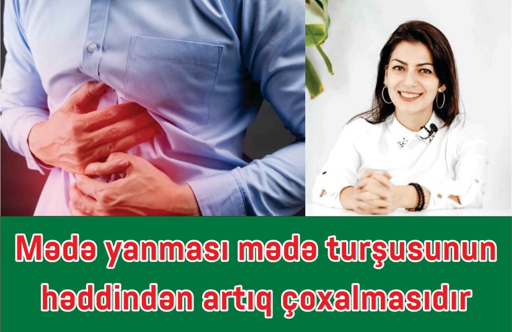 Mədə yanması