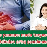 Mədə yanması