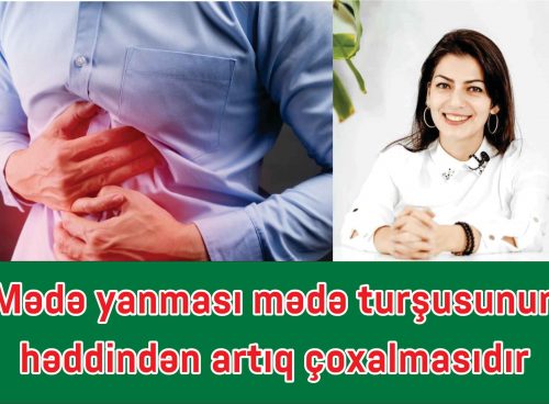 Mədə yanması